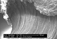 02 -Josh Workman SEM Cartilage-200px