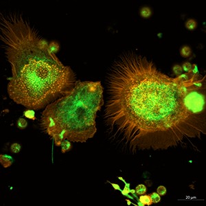 HC_CLSM_300px HC_CLSM_300px