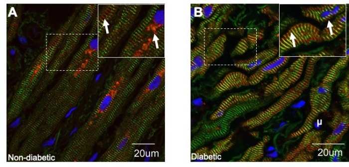 Exchange proteins activated by cAMP (Epac) Exchange proteins activated by cAMP (Epac)