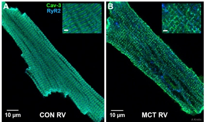 Isolated cardiomyocytes from control and hypertrophic rat hearts Isolated cardiomyocytes from control and hypertrophic rat hearts