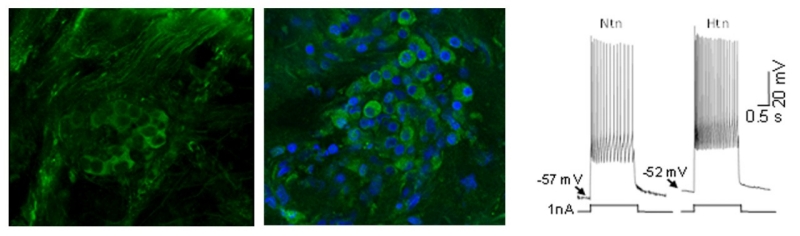 purinergic receptor banner purinergic receptor banner