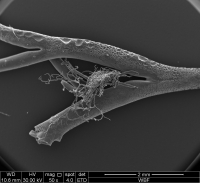 carotid bodies carotid bodies