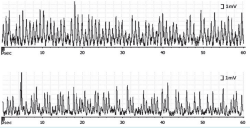 vasoconstrctor activity vasoconstrctor activity